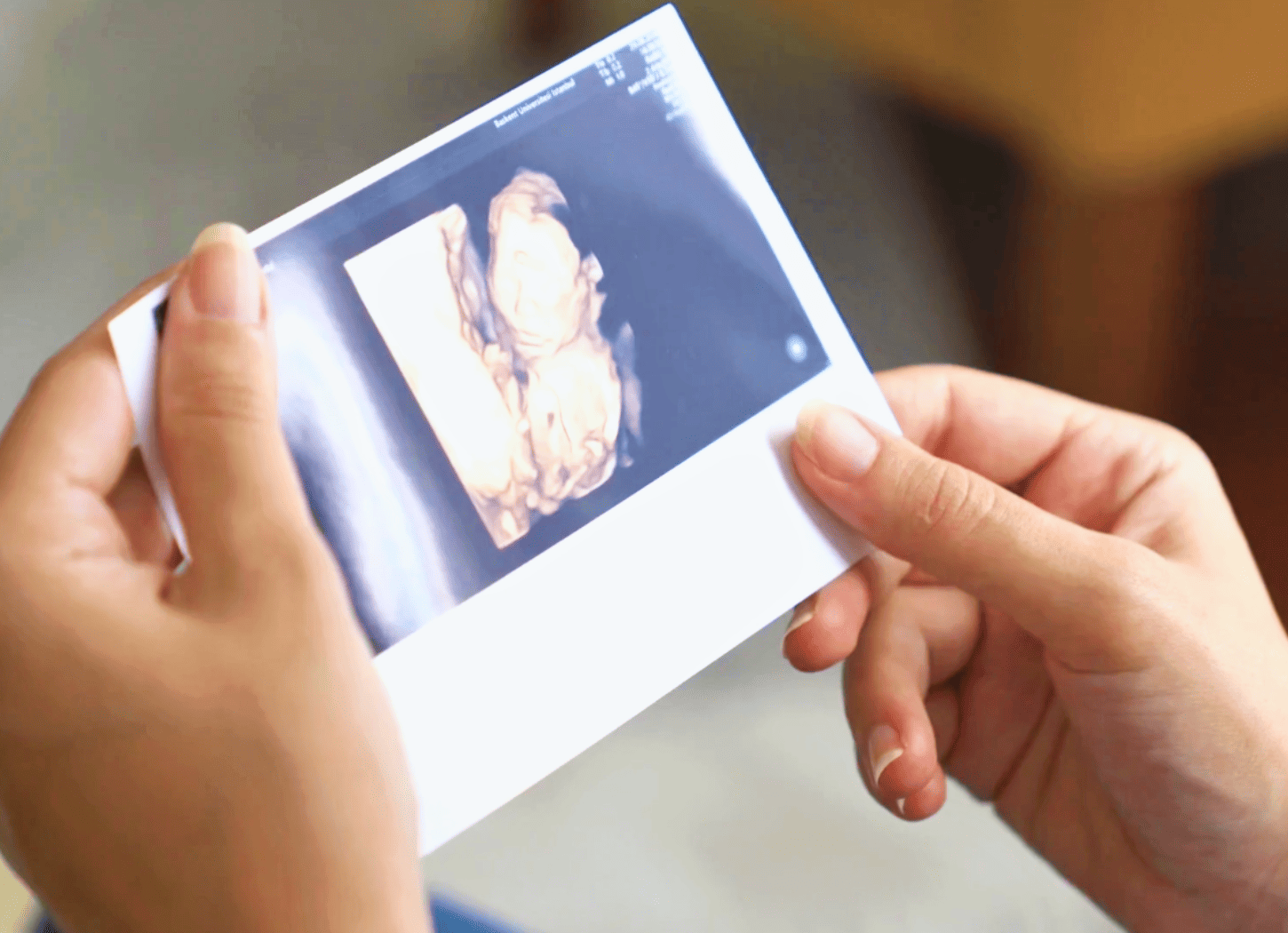 エコー写真を持つ手。お腹の中でスクスク育つ赤ちゃんの姿が写っており、もう一人の「ひろみちゃん」が妊娠しているイメージ。